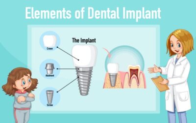 Who is the Best Nobel Active Implants Clinic in South Extension Part 1