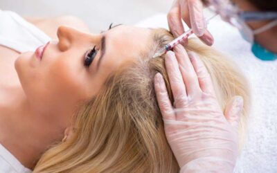 How to Choose the Right PRP Specialist for Hair Growth in South Extension