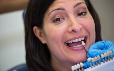 How to Choose the Best Noble Active Implants in South Extension 1?