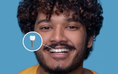 What Should You Expect When Getting a Zygomatic Implant at the Best Clinic in South Extension?