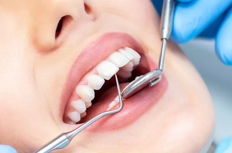 General Dentistry at Abhirachna Dental Clinic