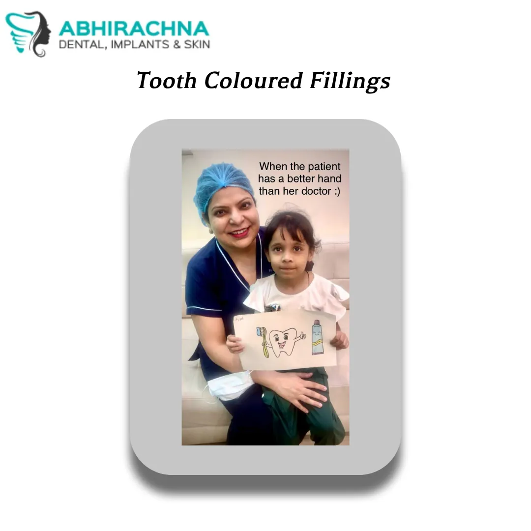 Tooth Coloured Fillings before and after result at Abhirachna Dental, South Extension - image 3