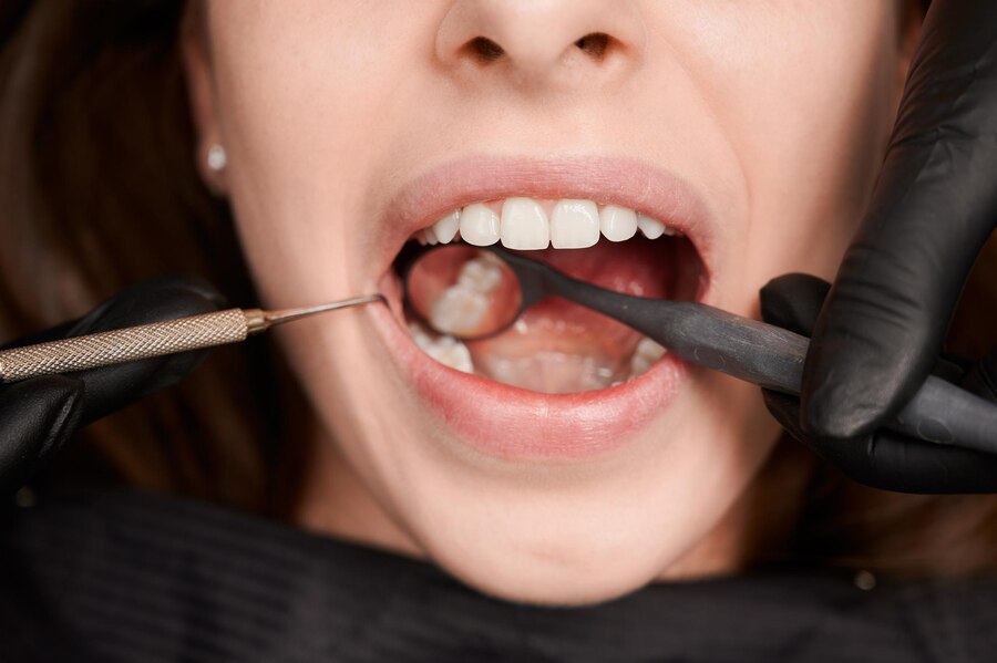 Where Can You Consult the Best Dental Surgeon in South Extension?