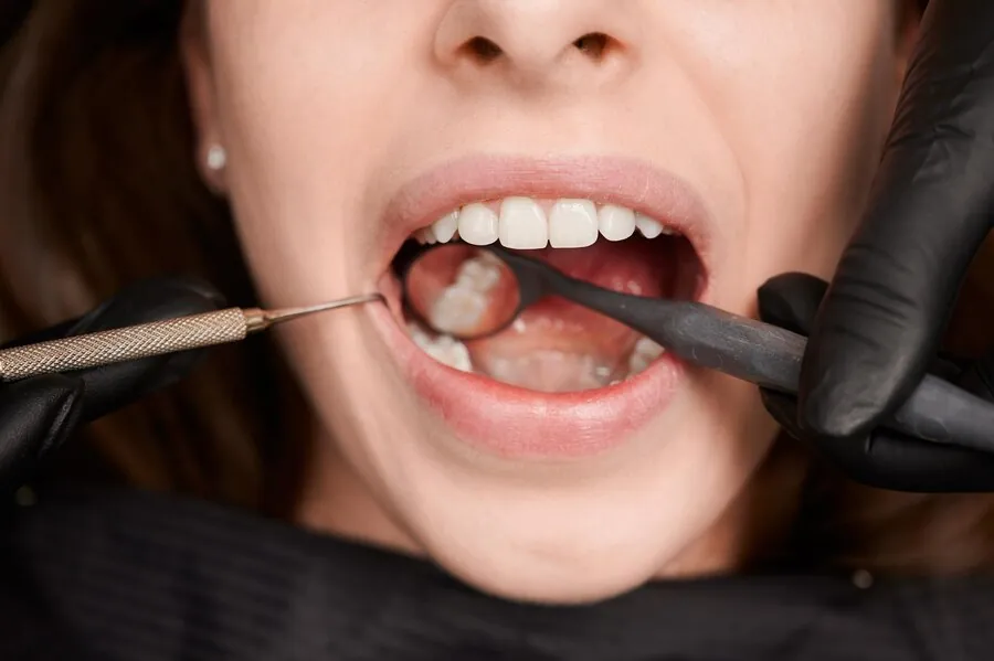 Which Dentist Offers the Best Root Canal Treatment in Greater Kailash?
