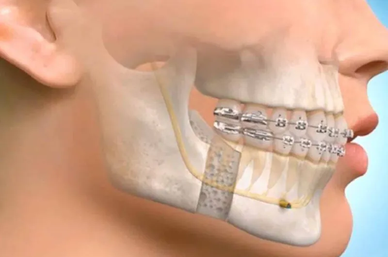 Maxillofacial Surgery at Abhirachna Dental Clinic