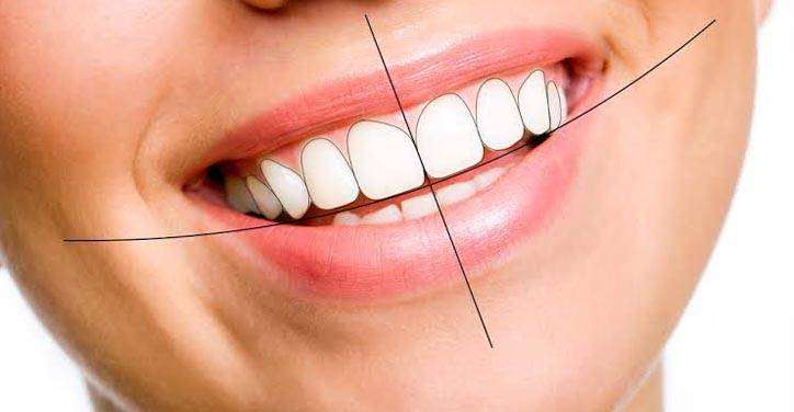 Why Choose the Best Smile Designing in New Delhi?