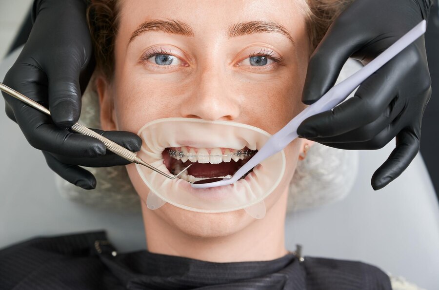 Maxillofacial Surgery in South Extension I: Transforming Smiles and Lives