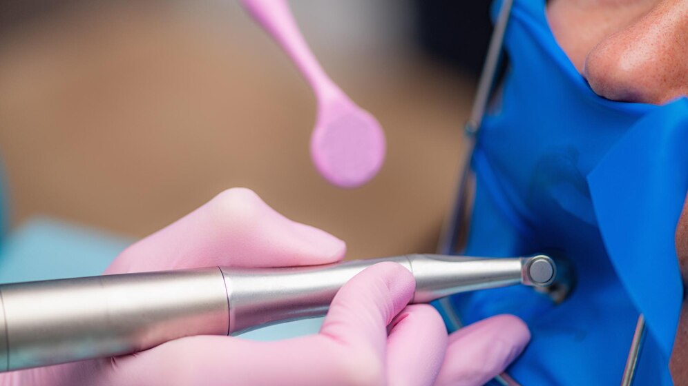 Best RCT Clinic in South Extention: Comprehensive Guide to Root Canal Treatment