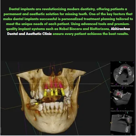 CBCT scan used for dental implant planning
