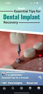 What are Pit & Fissure Sealants, and How Do They Protect Teeth from Cavities? Visit Abhirachna Dental and Aesthetic Clinic