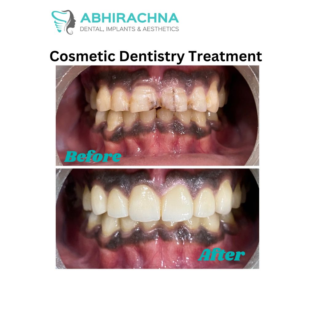 Discover how cosmetic dentistry can transform your smile in South Extension 1 with Dr. Archana Bhardwaj