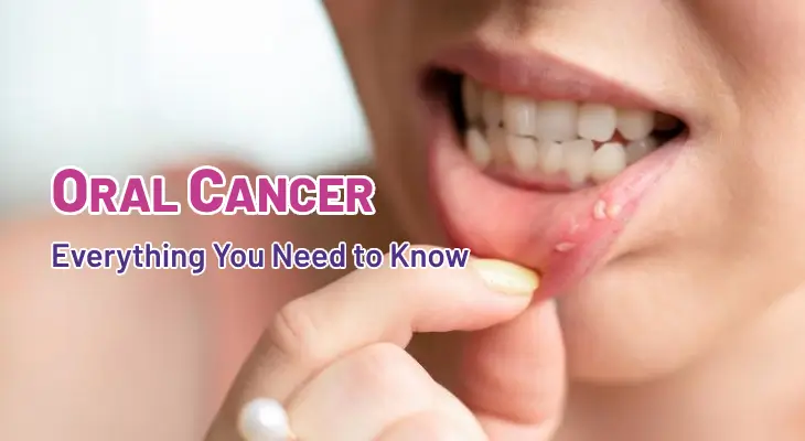 Which Is the Best Oral Cancer Treatment Center in South Extension?