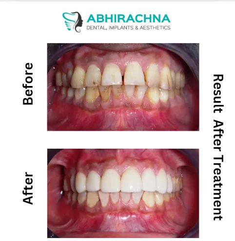 Where we Get the Best Teeth Whitening Clinic?