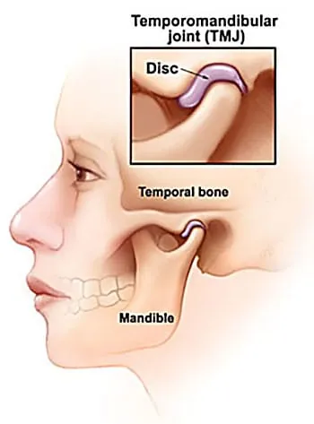 TMJ Surgery at Abhirachna Dental, South Extension