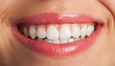 How to Find the Best Teeth Whitening Clinic?