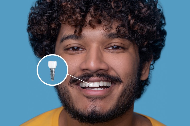 What Should You Expect When Getting a Zygomatic Implant at the Best Clinic in South Extension?