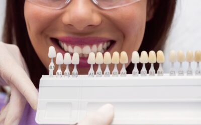 Where Can You Find the Best Dental Cosmetic Veneers and Laminates in South Delhi?