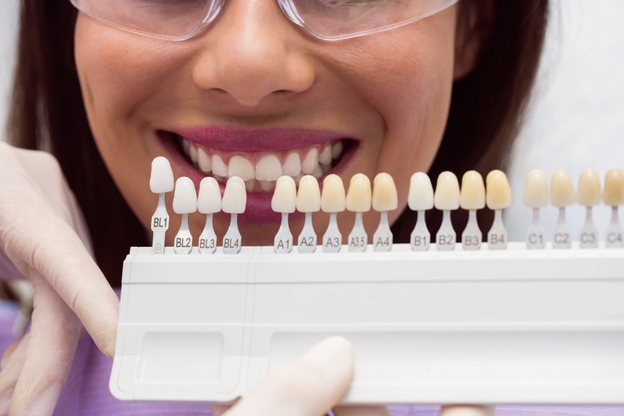 How Can the Best Dental Veneers in South Delhi Transform Your Smile?
