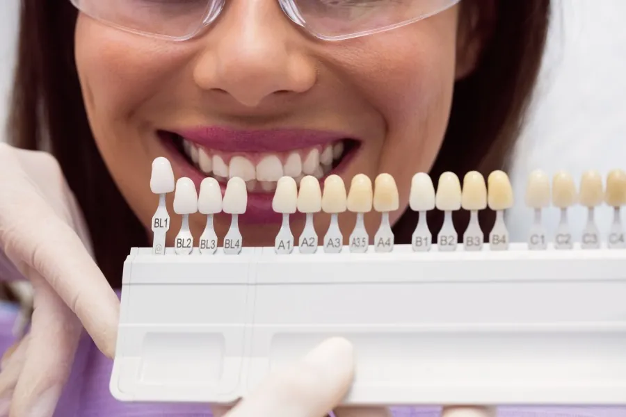 How Can the Best Dental Veneers in South Delhi Transform Your Smile?