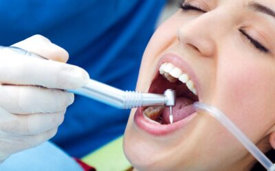 How Does Abhirachna Dental Manage Cavities in Children and Adults?