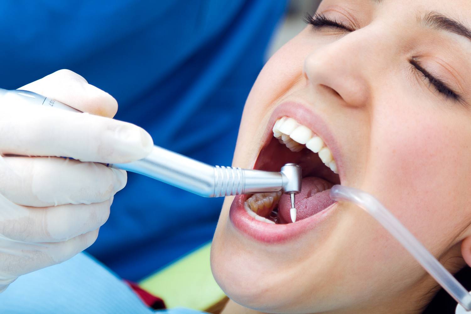 How Does Abhirachna Dental Manage Cavities in Children and Adults?