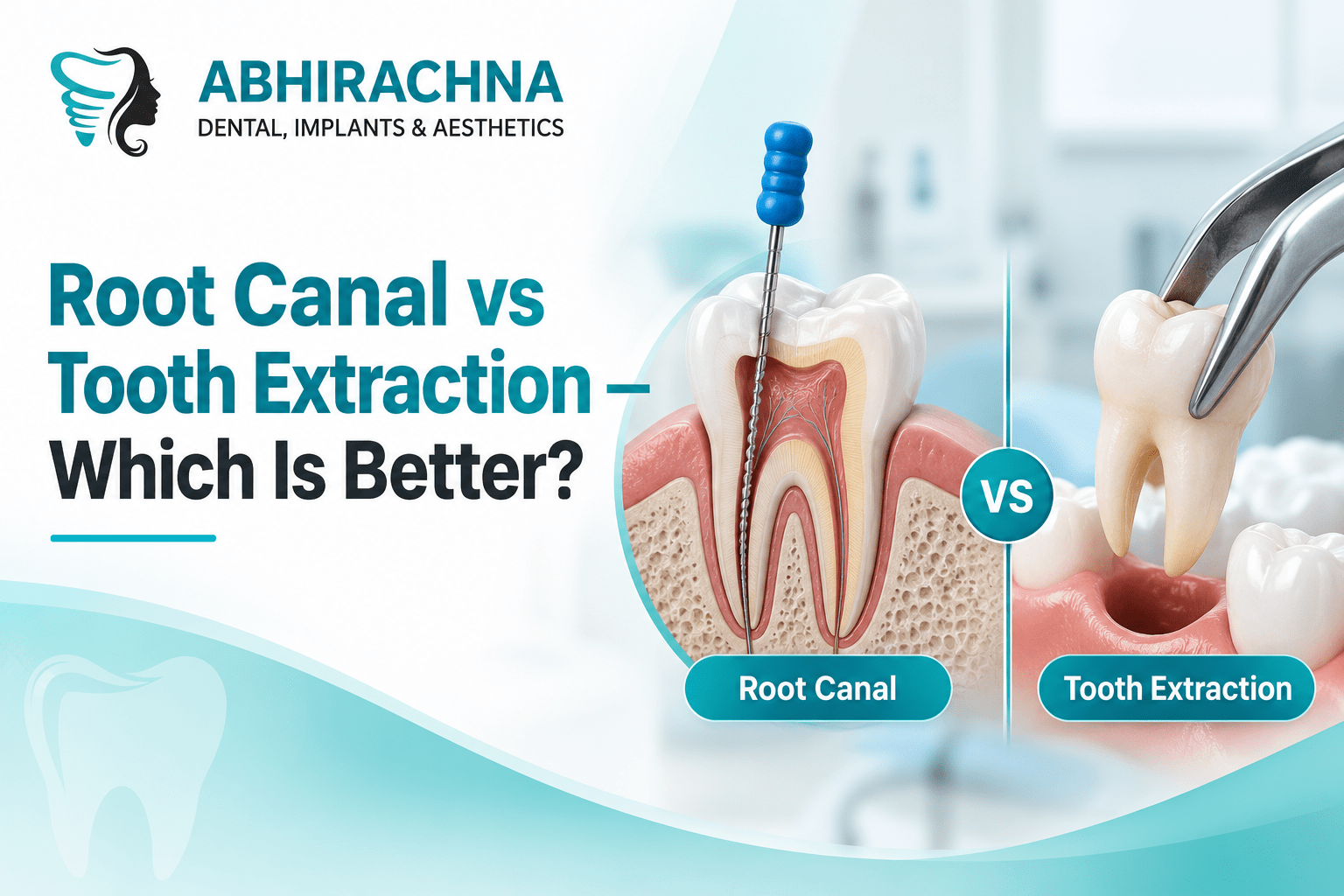Root Canal vs Tooth Extraction — Which Is Better?